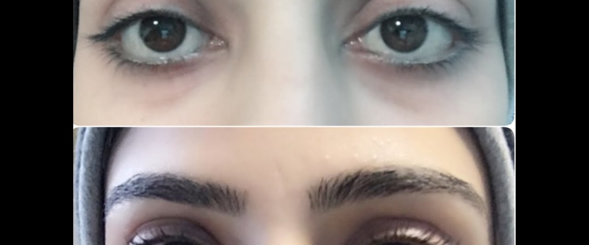 How do you get rid of an eye infection from eyelash extensions?