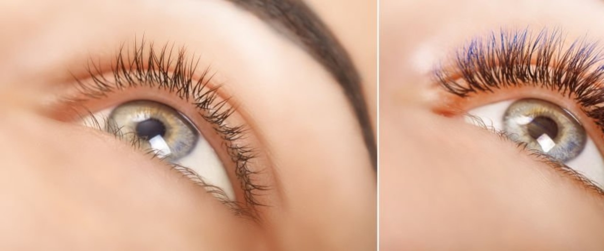 Can styes be caused by eyelash extensions?