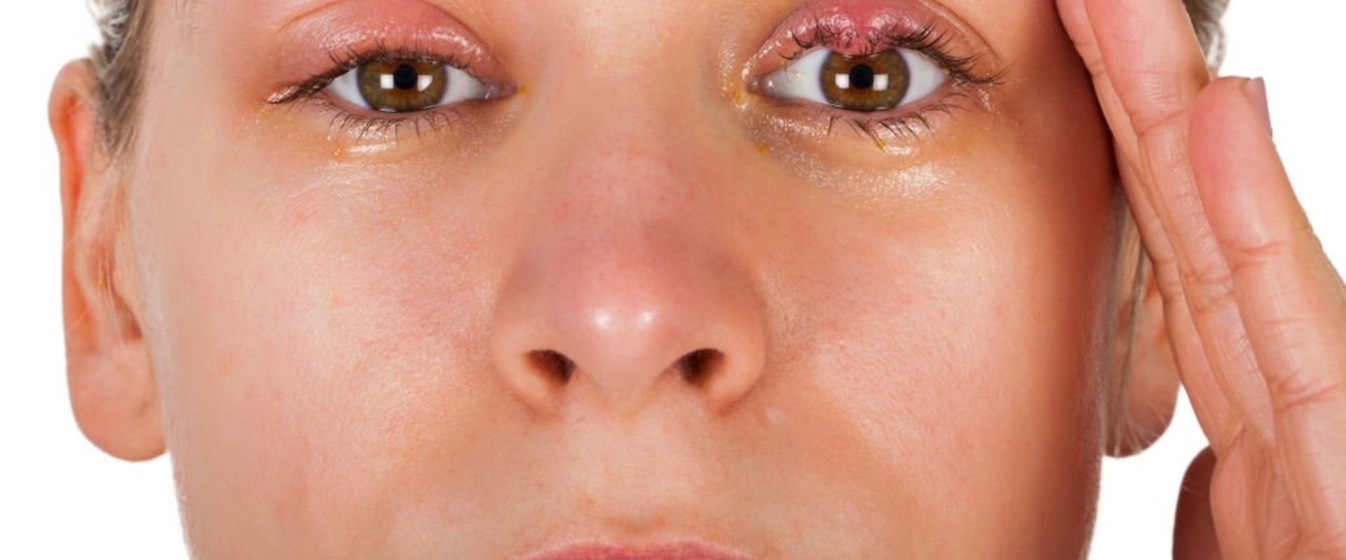 Can eyelash extension cause stye?