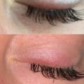 Can eyelash glue cause swollen eyelids?