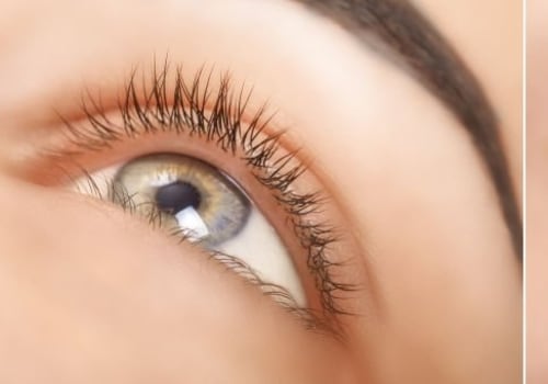 Can styes be caused by eyelash extensions?
